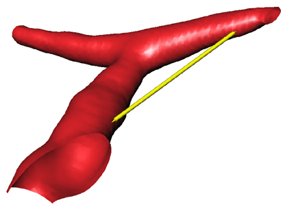 Length from surface to surface