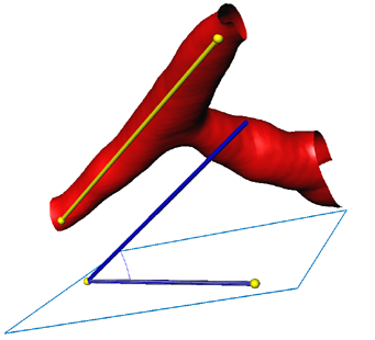 Angle from reference plane