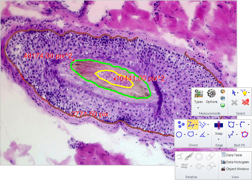 Manual and Auto Tracing